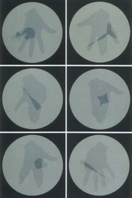 MAREK, MAX >Implantate< 2005 6-teilig je 50 x 50cm 150 x 100cm Besitz des Künstlers